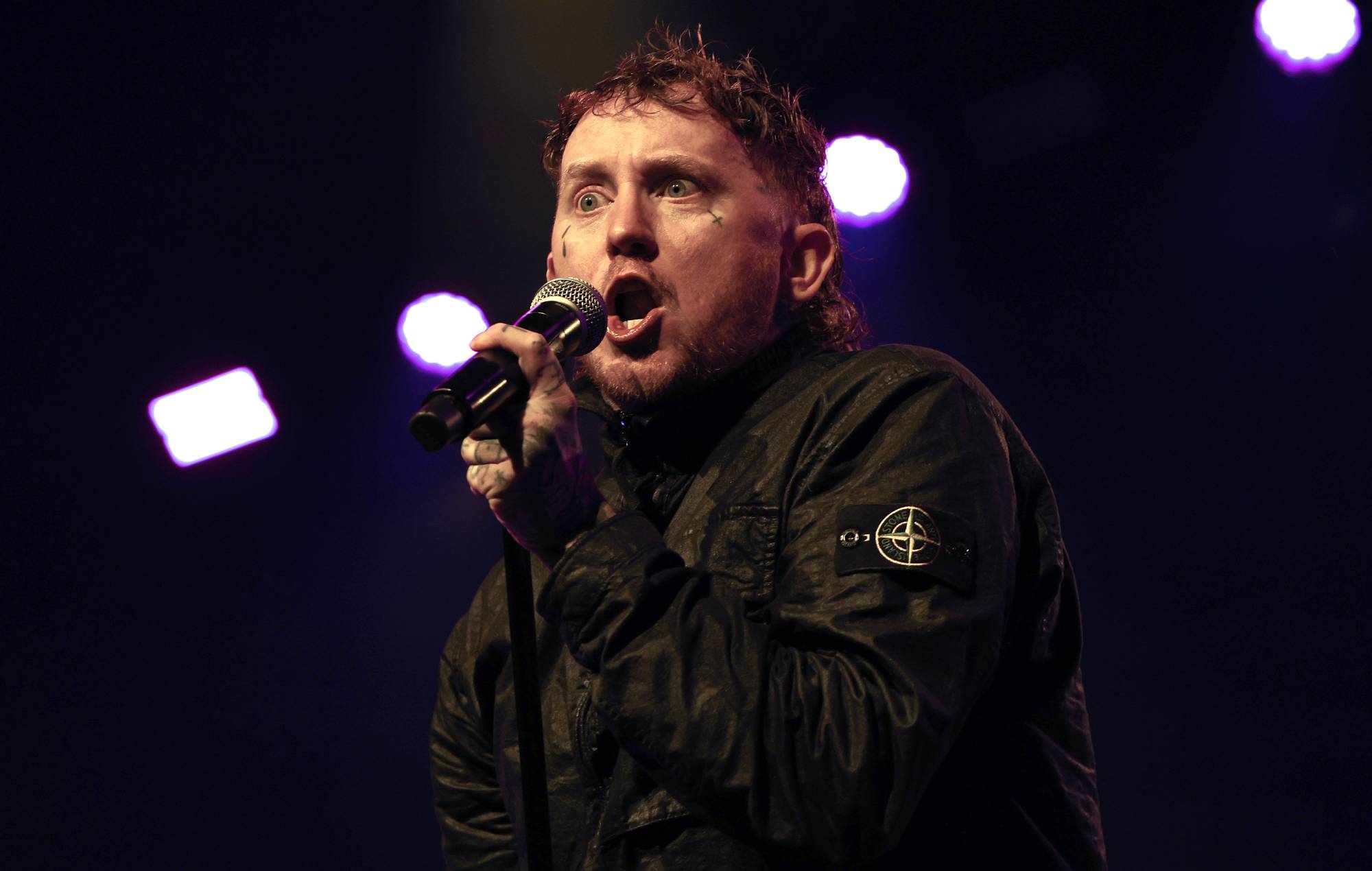 Frank Carter espelle un uomo dal concerto dei Sex Pistols dopo una lite tra sole donne: "Non è la tua esperienza vissuta, quindi stai zitto quel cazzo!"